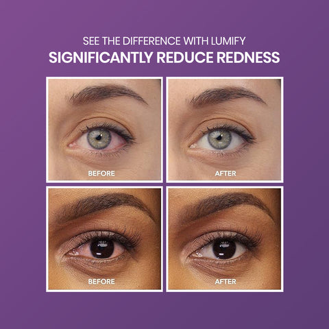 Before-and-after close-ups on a purple background show reduced redness after using Bausch + Lomb Lumify Eye Drops (2.5mL or 7.5mL), available in 1 or 3 month supplies, with the text “Significantly reduce redness.”.