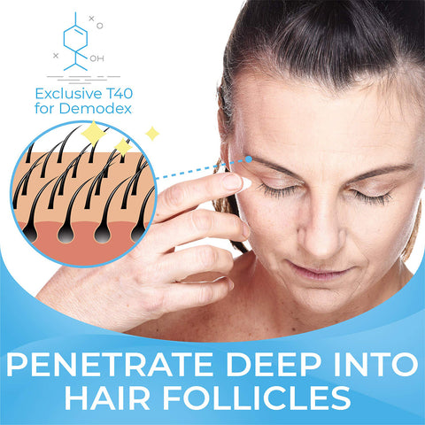 A woman uses Cliradex Light Foam Eyelash & Eyelid Cleanser. An illustration shows hair follicles with text: Exclusive T40 tea tree oil extract for Demodex, penetrates deep to support eyelid hygiene. Brand: Cliradex.