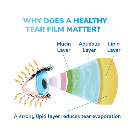 The Optase DryEye Kit illustration depicts an eyes tear film with mucin, aqueous, and lipid layers labeled. It emphasizes the lipid layers role in minimizing tear evaporation and aiding dry eye relief. Text reads, Why does a healthy tear film matter?.
