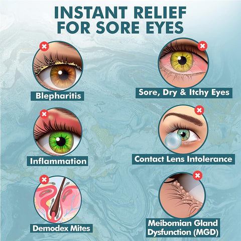 Graphic titled Instant Relief for Sore Eyes showcases six icons: Blepharitis, Sore, Dry & Itchy Eyes relieved with Noveha Hypochlorous Acid Eyelid and Lash Cleanser (30mL), Inflammation soothed, Contact Lens Intolerance, Demodex Mites addressed by an eyelid cleanser, and Meibomian Gland Dysfunction.