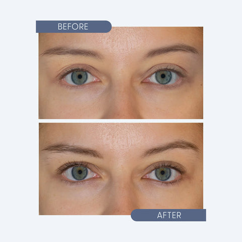 Close-up of eyes in two images labeled Before and After. In the Before image, lashes appear natural, while the After image shows longer, fuller lashes, suggesting enhancement with Twenty Twenty - Get Growing Lash & Brow Enhancing Serum (10ml Bottle).