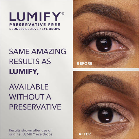Lumify Preservative Free Redness Reliever Vials (20ct)