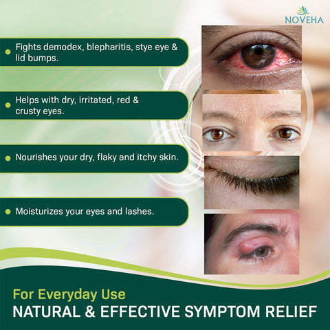 Infographic displays eye conditions and benefits, with images of red eyes and flaky skin. Highlights Noveha Demodex Eyelid Cleanser Foams extra strength tea tree oil for demodex, skin nourishment, and eye moisturization. Label: For Everyday Use - Natural & Effective Symptom Relief.