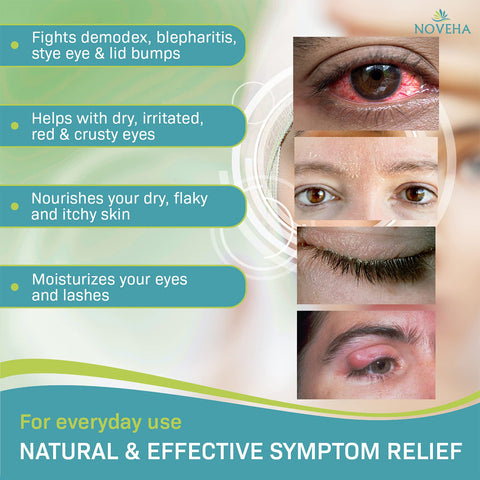 NOVEHAs eye relief graphic showcases the benefits of Noveha Tea Tree Oil Foaming Cleanser for Eyelids (100mL): fights demodex, blepharitis, styes; soothes dry, irritated eyes; nourishes skin and moisturizes lashes. Includes images of eye conditions.