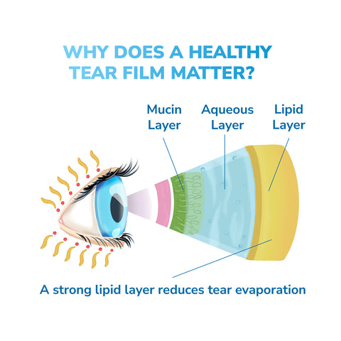 A diagram illustrating an eye with tear film layers: mucin, aqueous, lipid. Text asks, WHY DOES A HEALTHY TEAR FILM MATTER? followed by A strong lipid layer reduces tear evaporation. Arrows link each layer to its label. Consider the Optase Moist Heat Dry Eye Mask for relief.