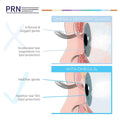 An illustration contrasts omega-3 deficient eyes with healthy ones. The top shows inflamed, clogged glands and rapid tear evaporation, while the bottom displays healthier glands and a tear film boosted by PRN DE3 Dry Eye Omega Benefits® for protection.