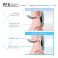 Illustration comparing omega-3 deficient eyes to those benefitting from PRN Dry Eye Omega Benefits® Liquid by PRN. Top: Inflamed, clogged glands with fast tear evaporation. Bottom: Healthier glands with improved tear film protection for dry eye relief.