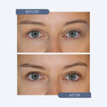 Close-up of eyes in two images labeled Before and After. In the Before image, lashes appear natural, while the After image shows longer, fuller lashes, suggesting enhancement with Twenty Twenty - Get Growing Lash & Brow Enhancing Serum (10ml Bottle).